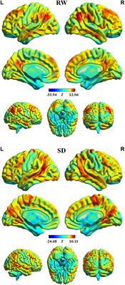 Altered stability of brain functional architecture after sleep deprivation: A resting-state functional magnetic resonance imaging study